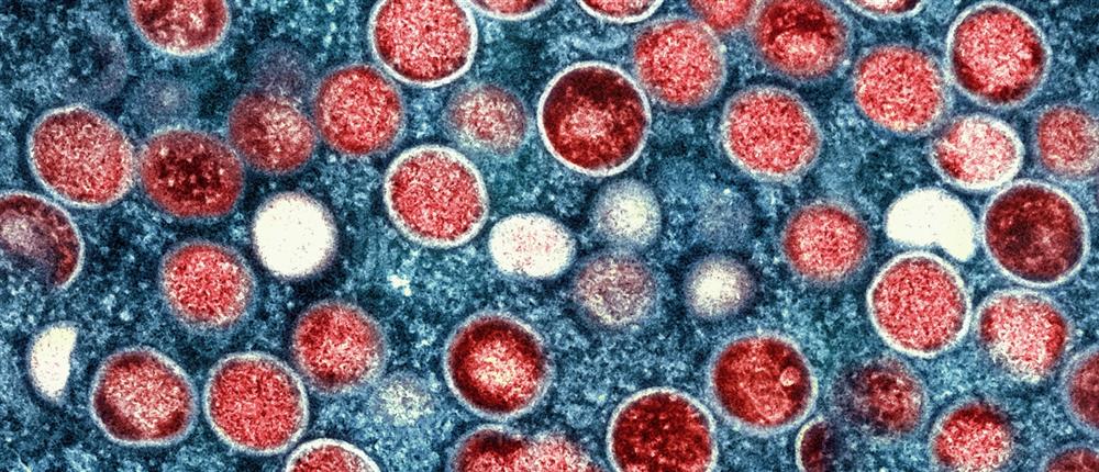 Ευλογιά των πιθήκων Ευλογιά των πιθήκων