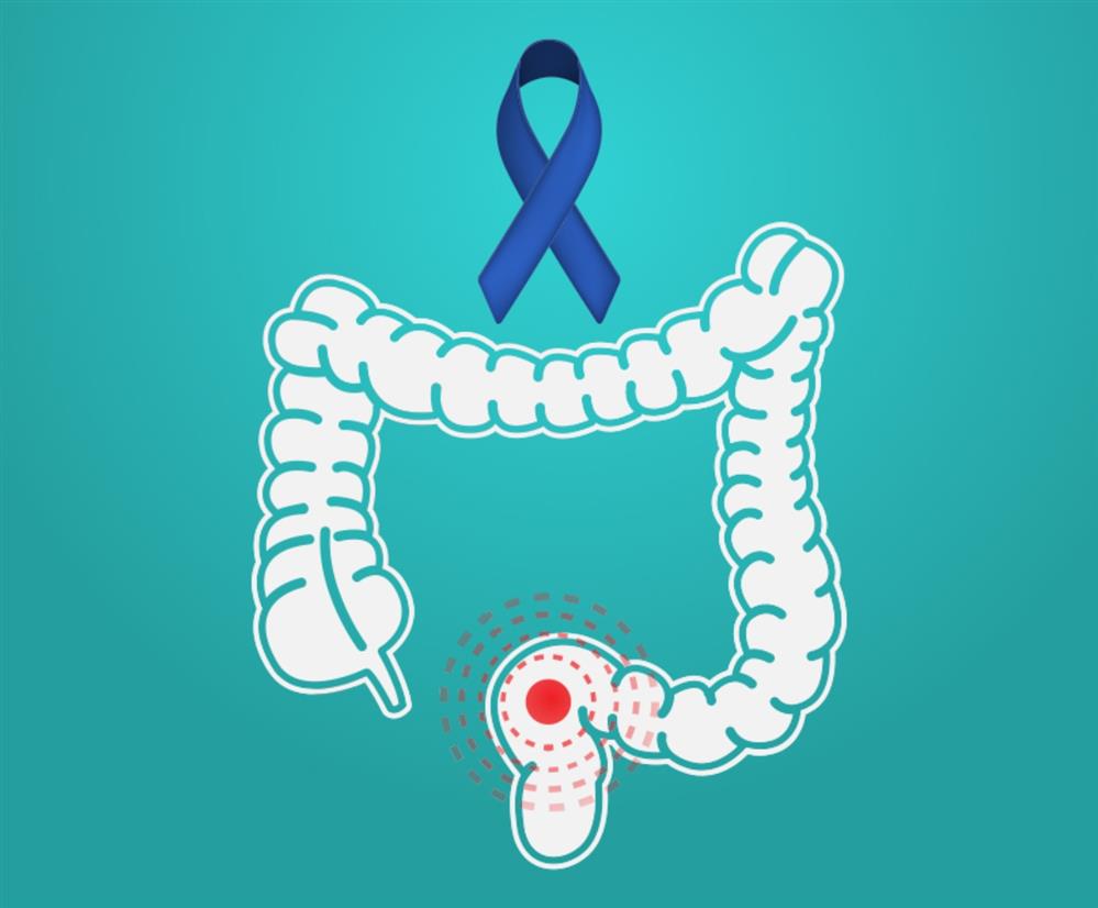 HHG - Λιάκος HHG - Λιάκος